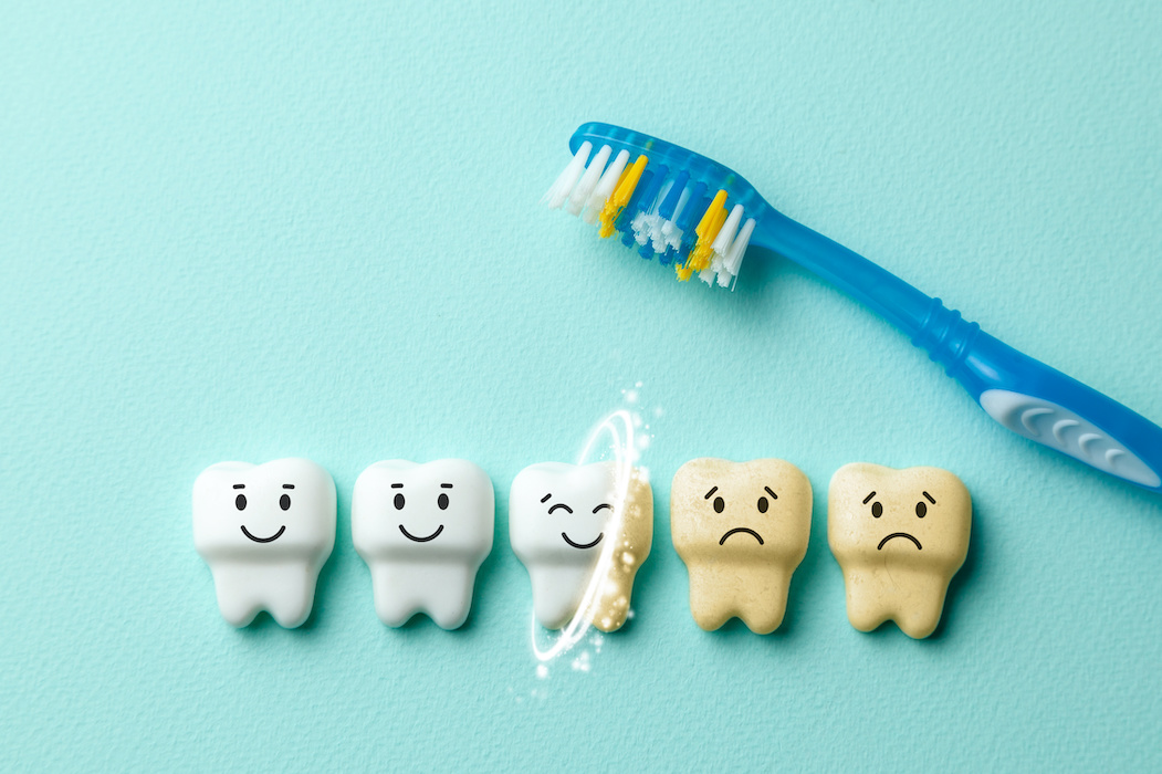 Read more about the article Limpeza Dentária – o que é, e porque é importante?